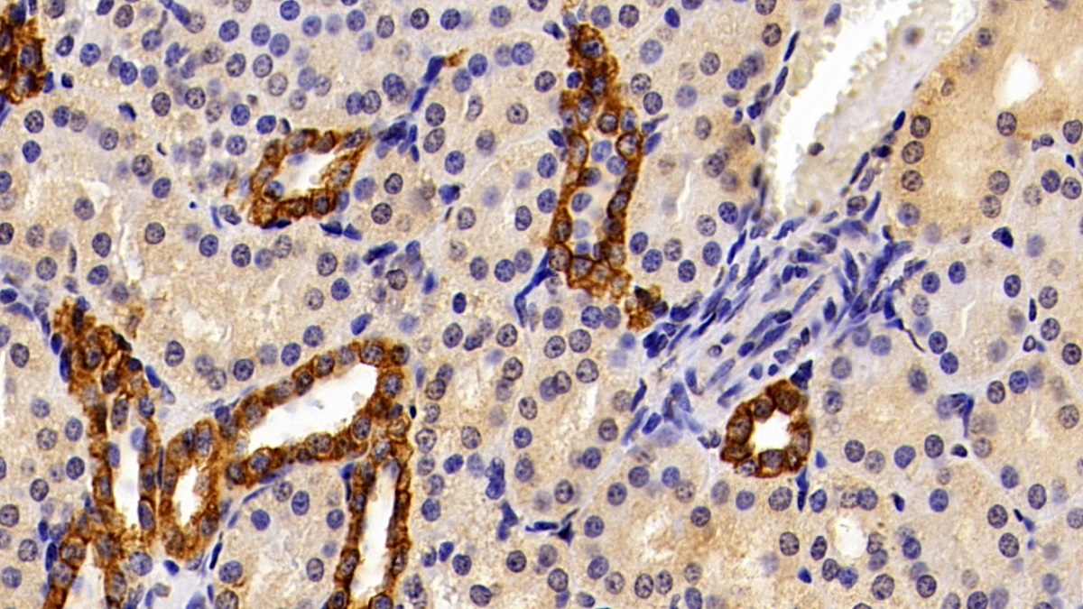 Polyclonal Antibody to Cytokeratin 19 (CK19)