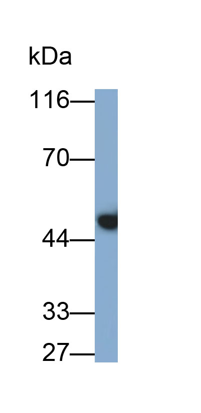 Polyclonal Antibody to Cytokeratin 19 (CK19)