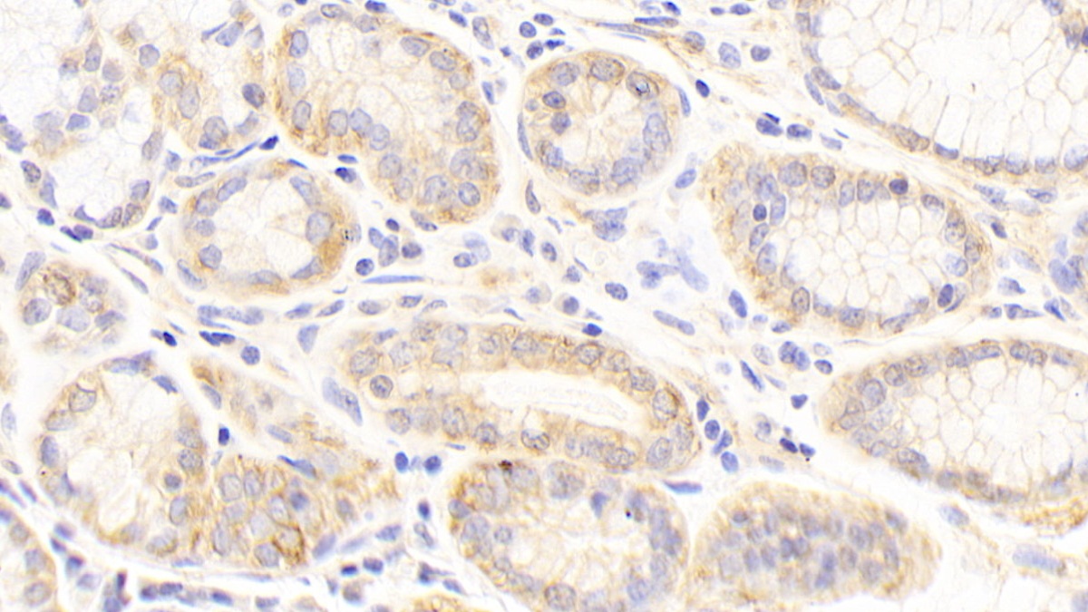 Polyclonal Antibody to Cytokeratin 19 (CK19)