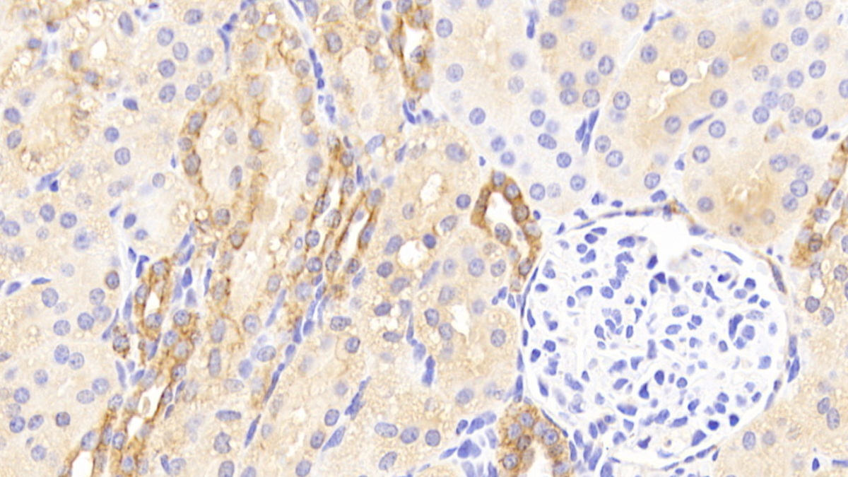 Polyclonal Antibody to Cytokeratin 19 (CK19)