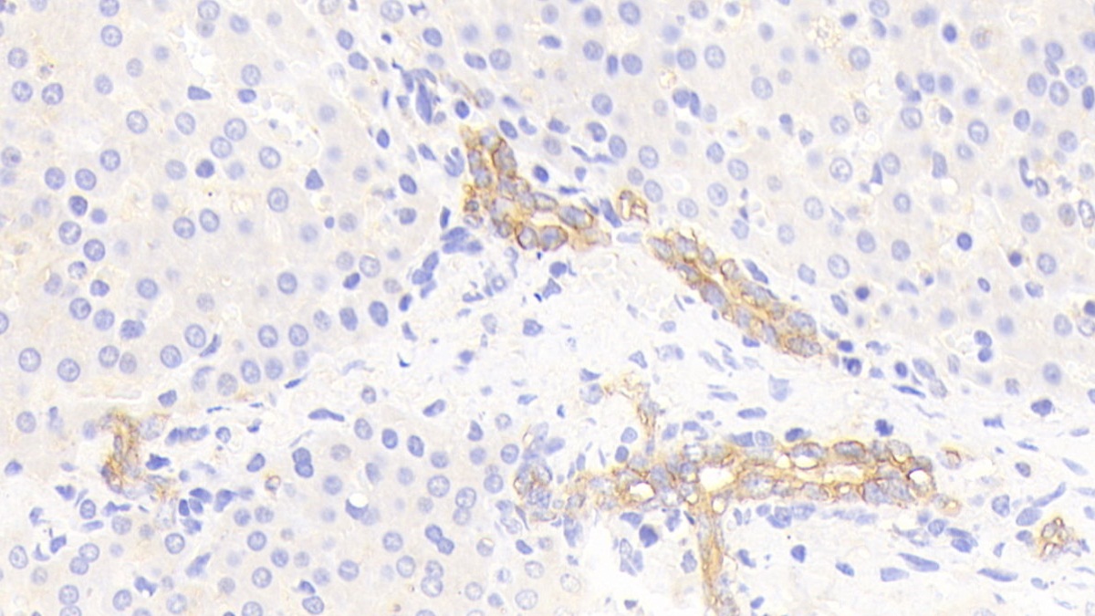 Polyclonal Antibody to Cytokeratin 19 (CK19)