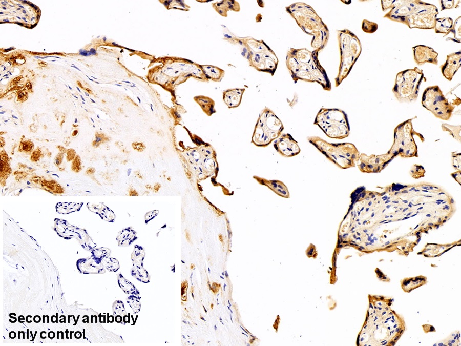 Polyclonal Antibody to Cytokeratin 19 (CK19)