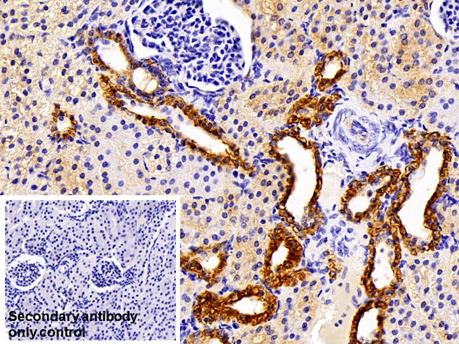 Polyclonal Antibody to Cytokeratin 19 (CK19)