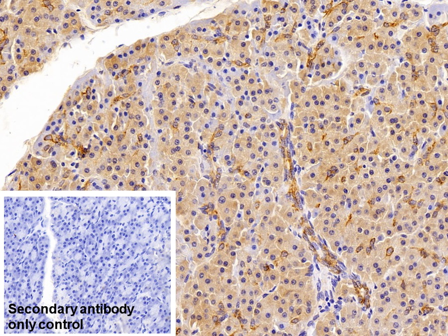 Polyclonal Antibody to Cytokeratin 19 (CK19)