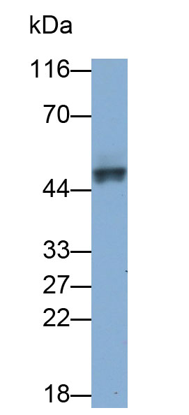 Polyclonal Antibody to Cytokeratin 19 (CK19)