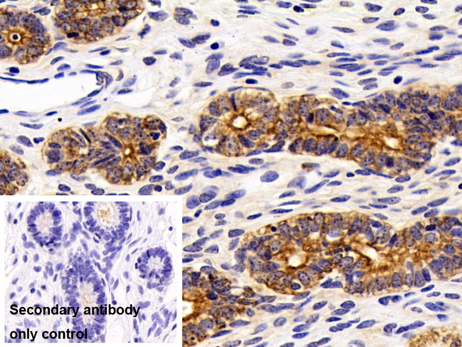 Polyclonal Antibody to Cytokeratin 19 (CK19)