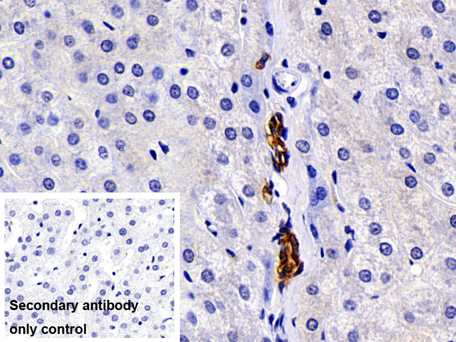 Polyclonal Antibody to Cytokeratin 19 (CK19)