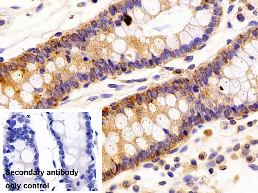 Polyclonal Antibody to Cytokeratin 19 (CK19)