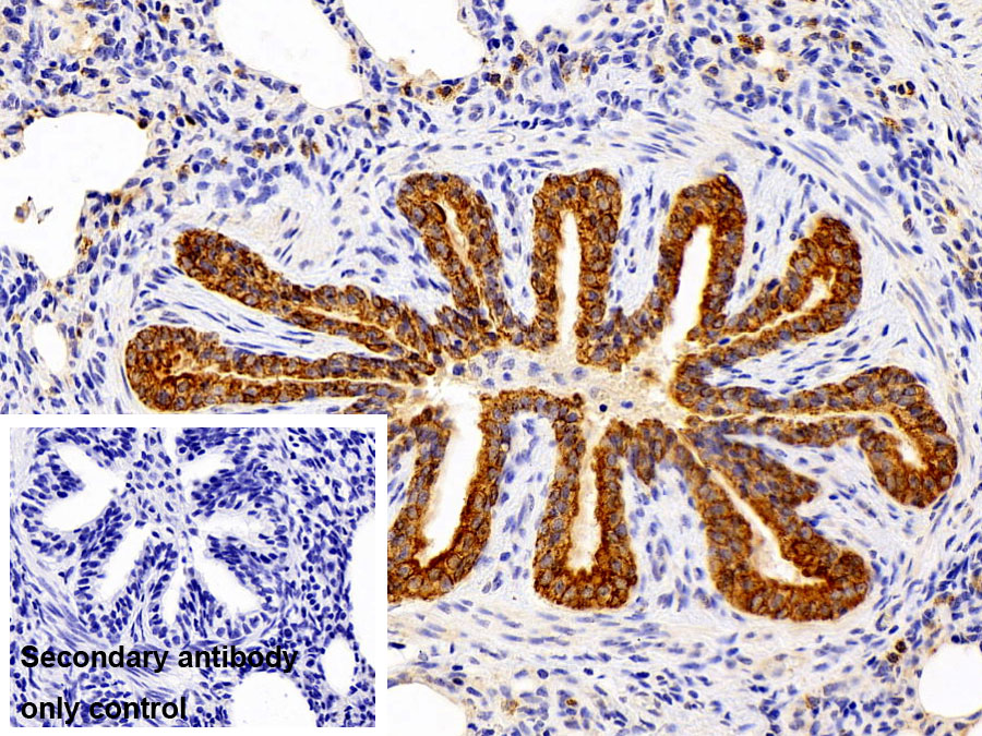 Polyclonal Antibody to Cytokeratin 19 (CK19)