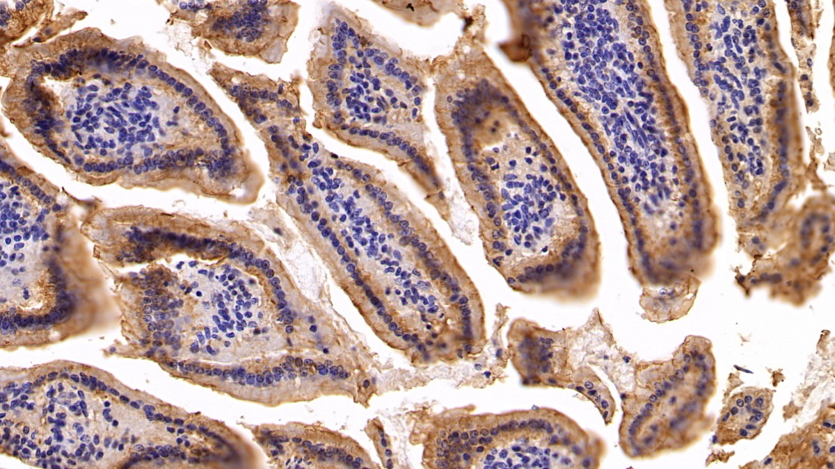 Polyclonal Antibody to Cytokeratin 19 (CK19)