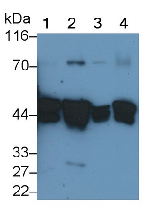 Polyclonal Antibody to Cytokeratin 19 (CK19)