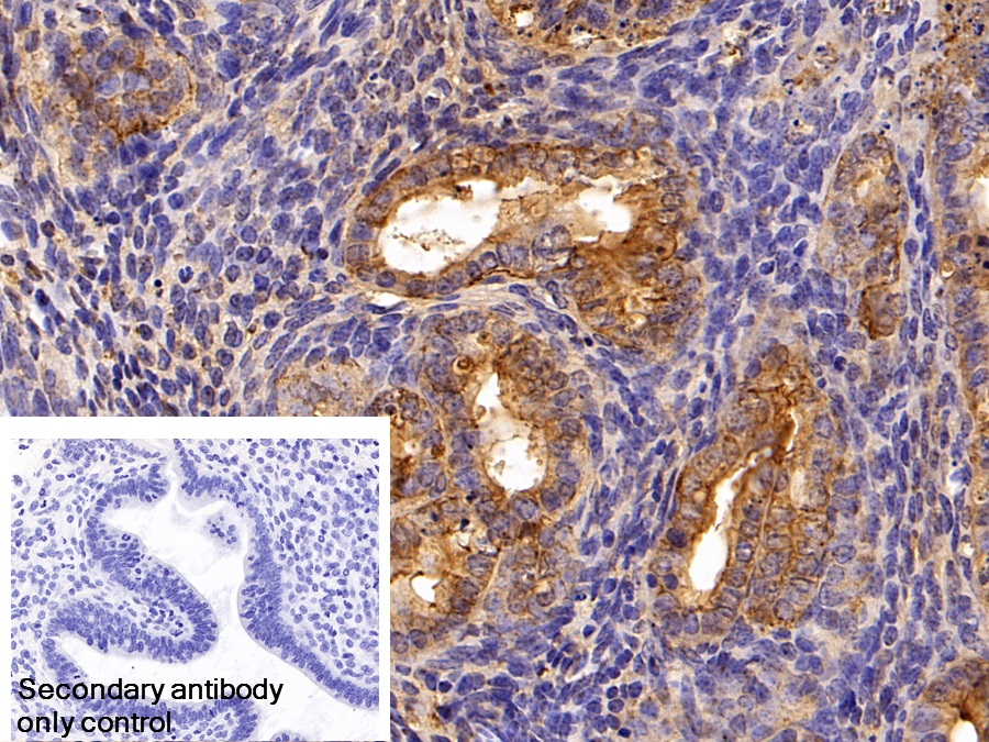 Polyclonal Antibody to Cytokeratin 19 (CK19)