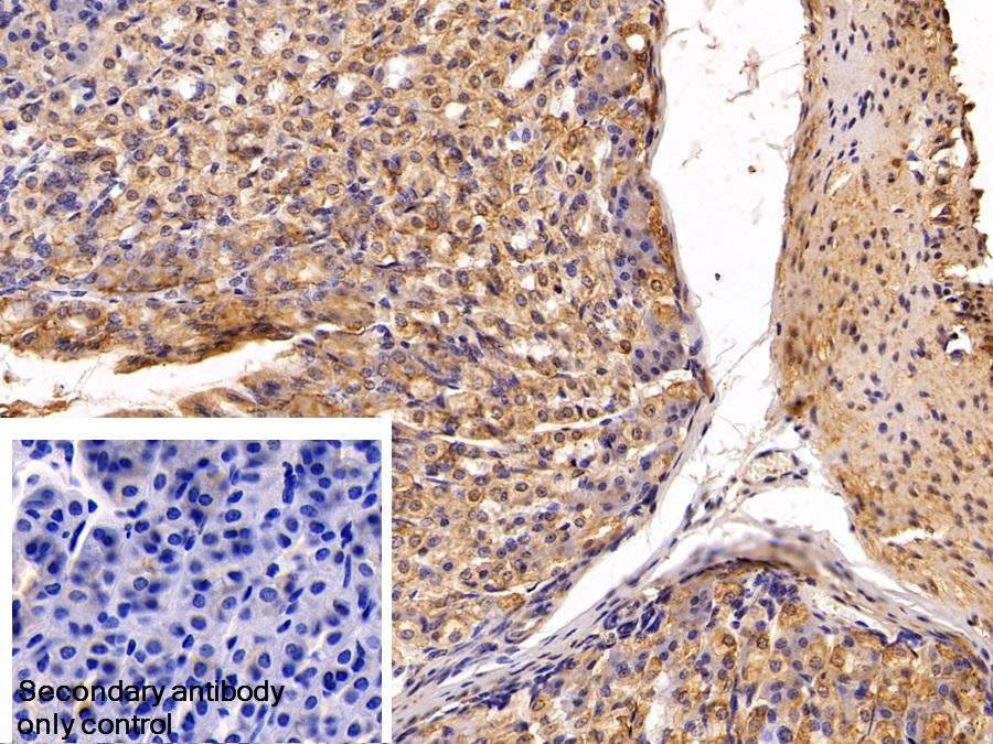 Polyclonal Antibody to Cytokeratin 19 (CK19)