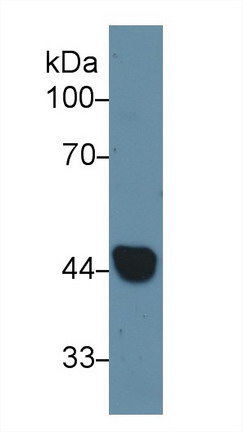 Polyclonal Antibody to Cytokeratin 19 (CK19)