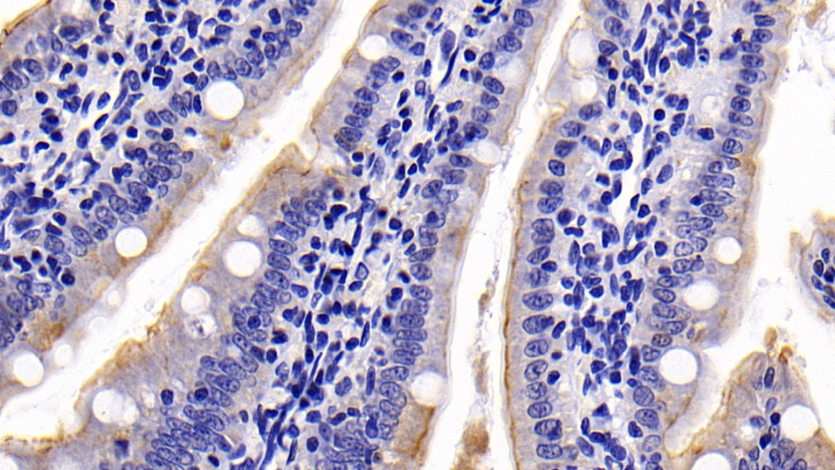 Polyclonal Antibody to Cytokeratin 19 (CK19)