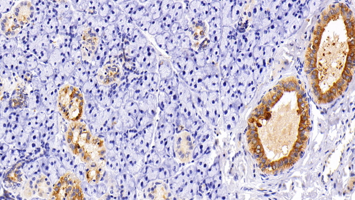 Polyclonal Antibody to Cytokeratin 19 (CK19)