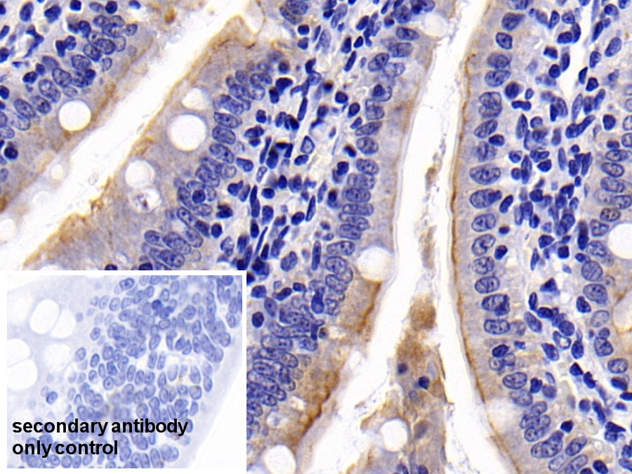 Polyclonal Antibody to Cytokeratin 19 (CK19)