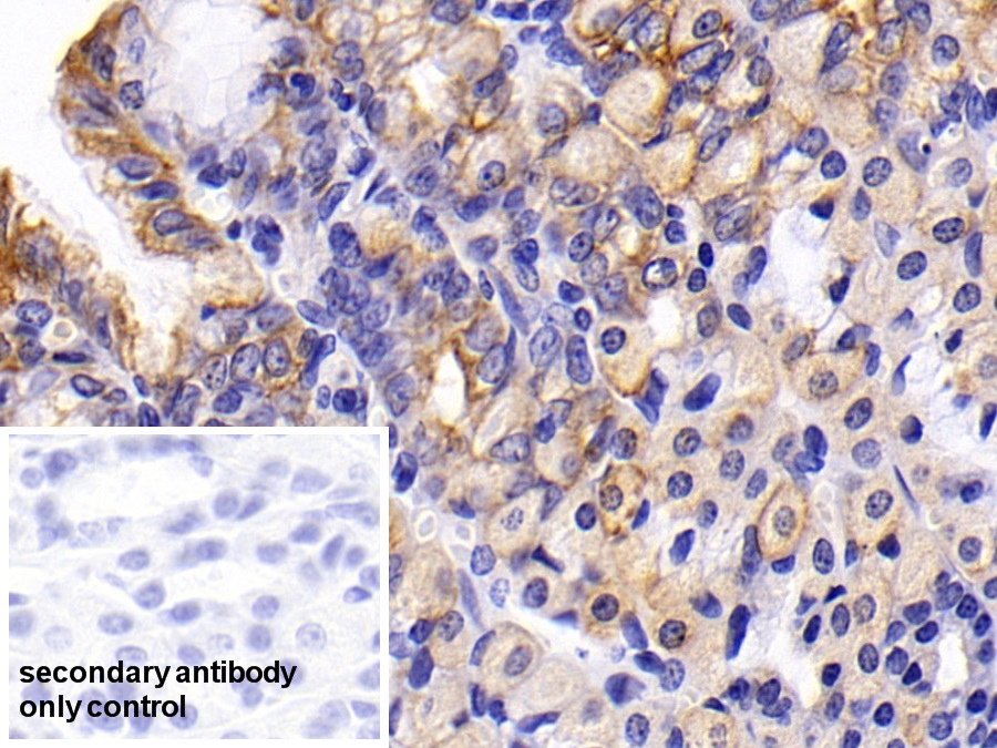 Polyclonal Antibody to Cytokeratin 19 (CK19)