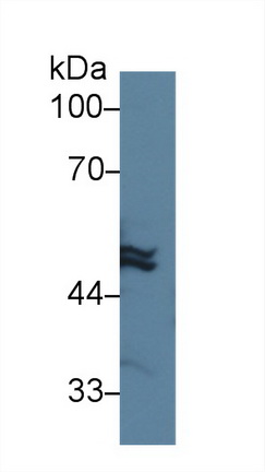 Polyclonal Antibody to Cytokeratin 20 (CK 20)