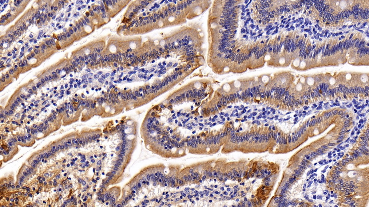 Polyclonal Antibody to Cytokeratin 20 (CK 20)