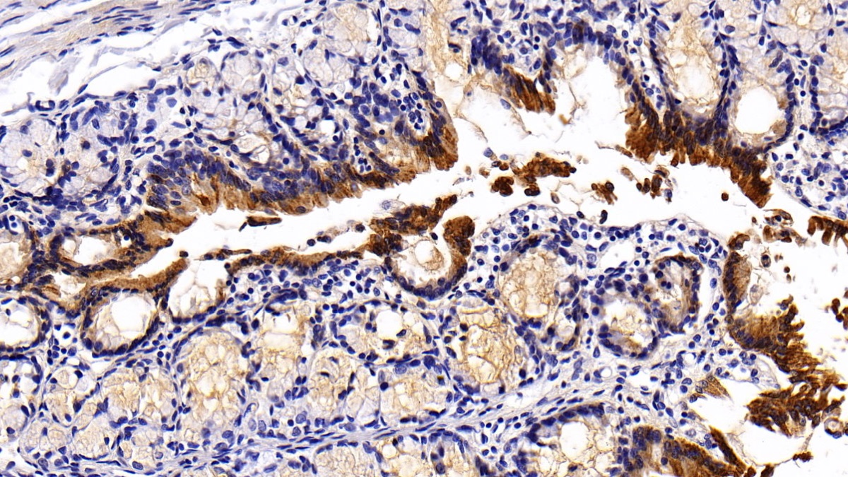 Polyclonal Antibody to Cytokeratin 20 (CK 20)