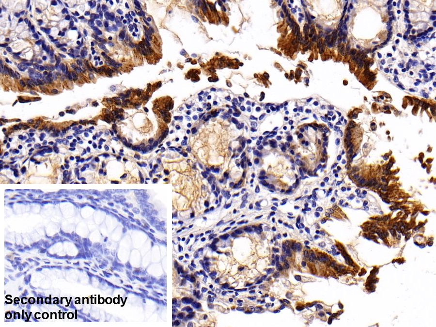 Polyclonal Antibody to Cytokeratin 20 (CK 20)