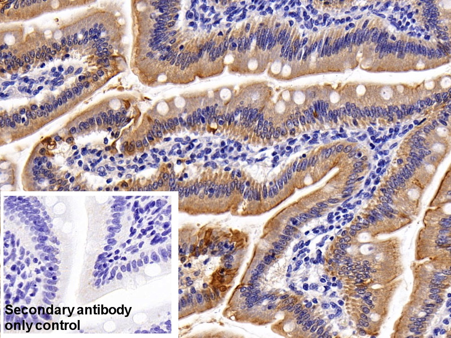 Polyclonal Antibody to Cytokeratin 20 (CK 20)