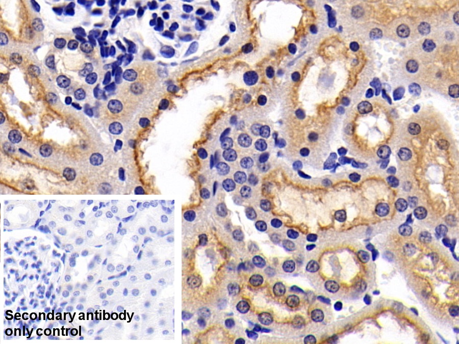 Polyclonal Antibody to Cytokeratin 20 (CK 20)