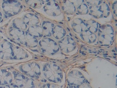 Polyclonal Antibody to ATP Binding Cassette Transporter A1 (ABCA1)