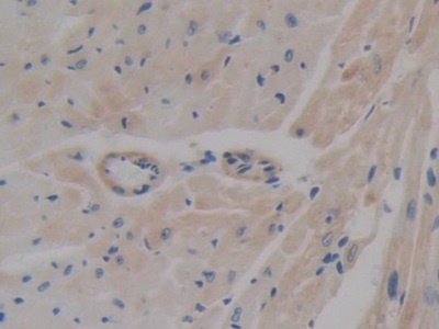 Polyclonal Antibody to ATP Binding Cassette Transporter A1 (ABCA1)