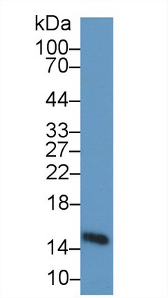 Polyclonal Antibody to Heart-type Fatty Acid Binding Protein (H-FABP)