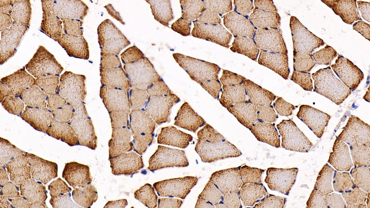 Polyclonal Antibody to Heart-type Fatty Acid Binding Protein (H-FABP)