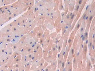 Polyclonal Antibody to Heart-type Fatty Acid Binding Protein (H-FABP)