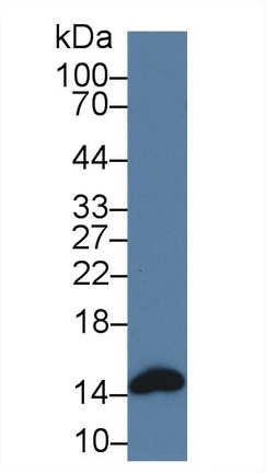 Polyclonal Antibody to Heart-type Fatty Acid Binding Protein (H-FABP)