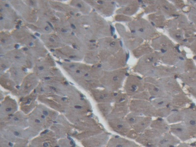 Polyclonal Antibody to Heart-type Fatty Acid Binding Protein (H-FABP)