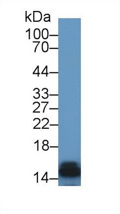 Polyclonal Antibody to Heart-type Fatty Acid Binding Protein (H-FABP)