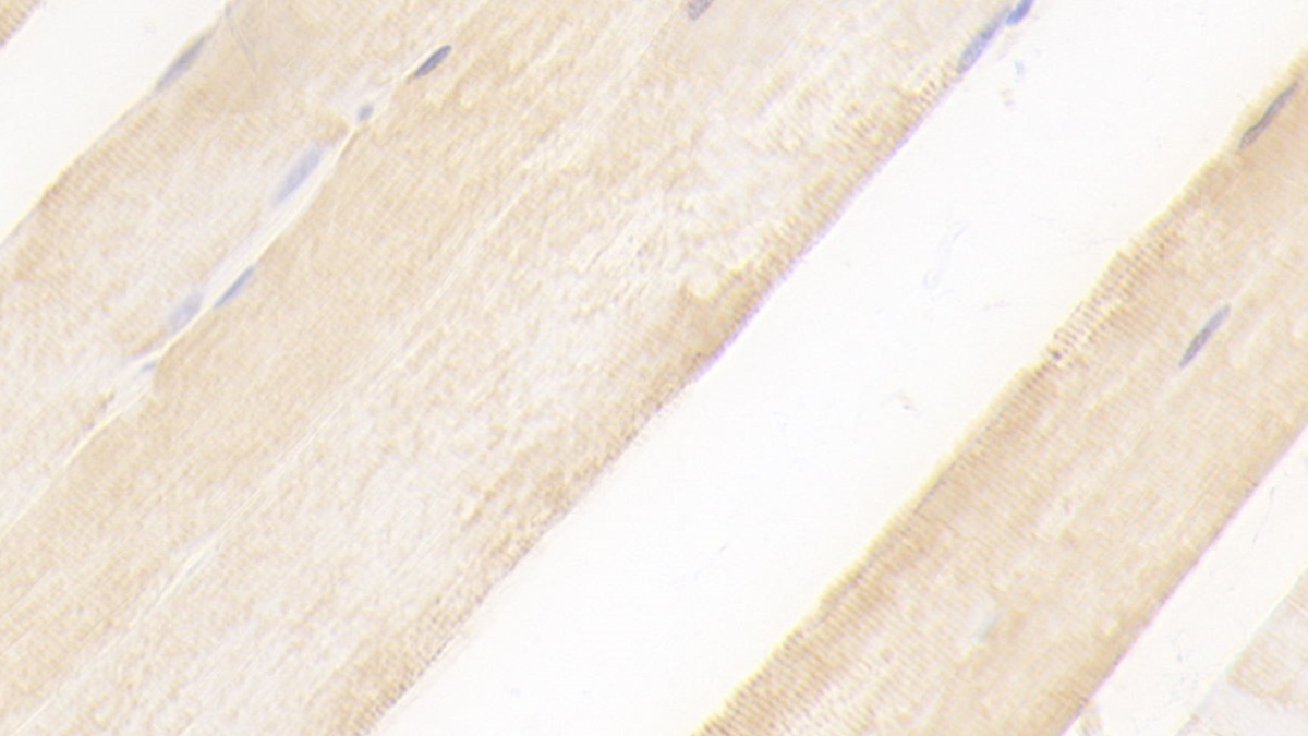 Polyclonal Antibody to Heart-type Fatty Acid Binding Protein (H-FABP)