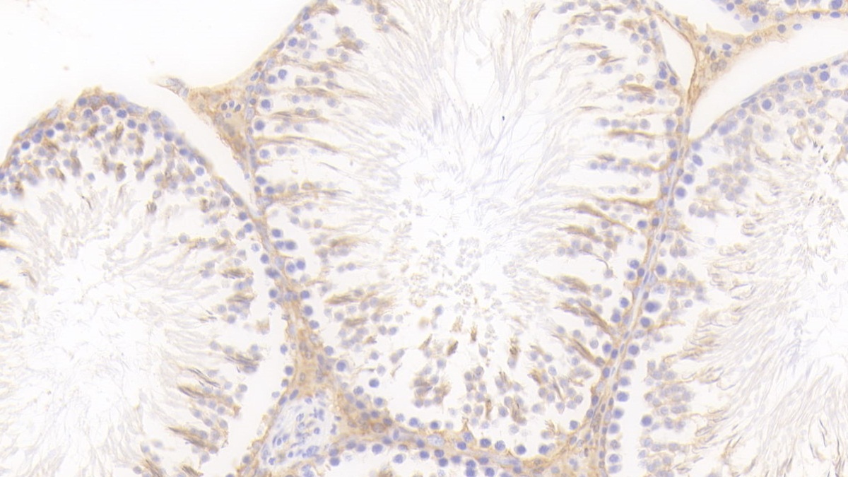 Polyclonal Antibody to Heart-type Fatty Acid Binding Protein (H-FABP)