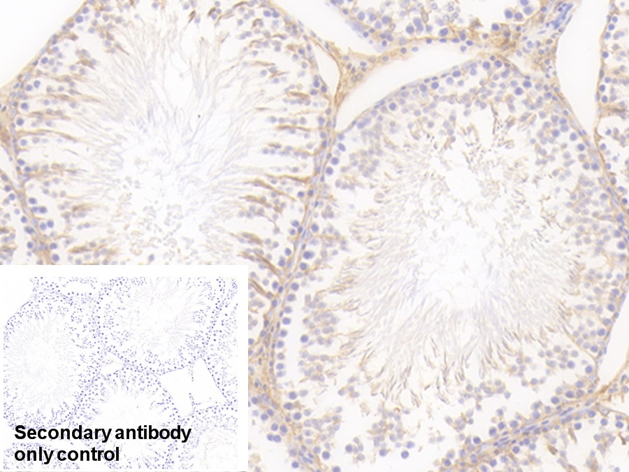 Polyclonal Antibody to Heart-type Fatty Acid Binding Protein (H-FABP)