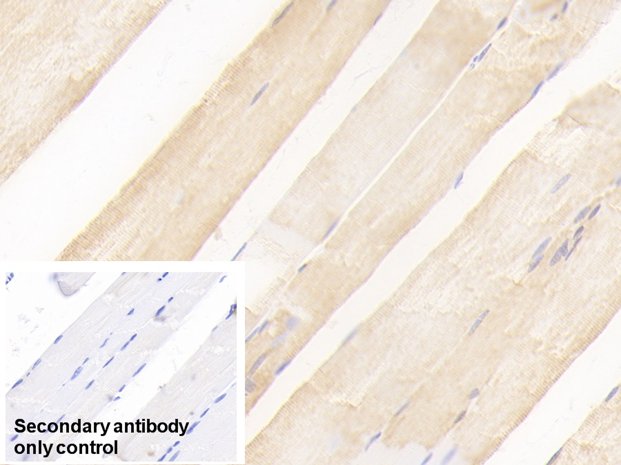 Polyclonal Antibody to Heart-type Fatty Acid Binding Protein (H-FABP)