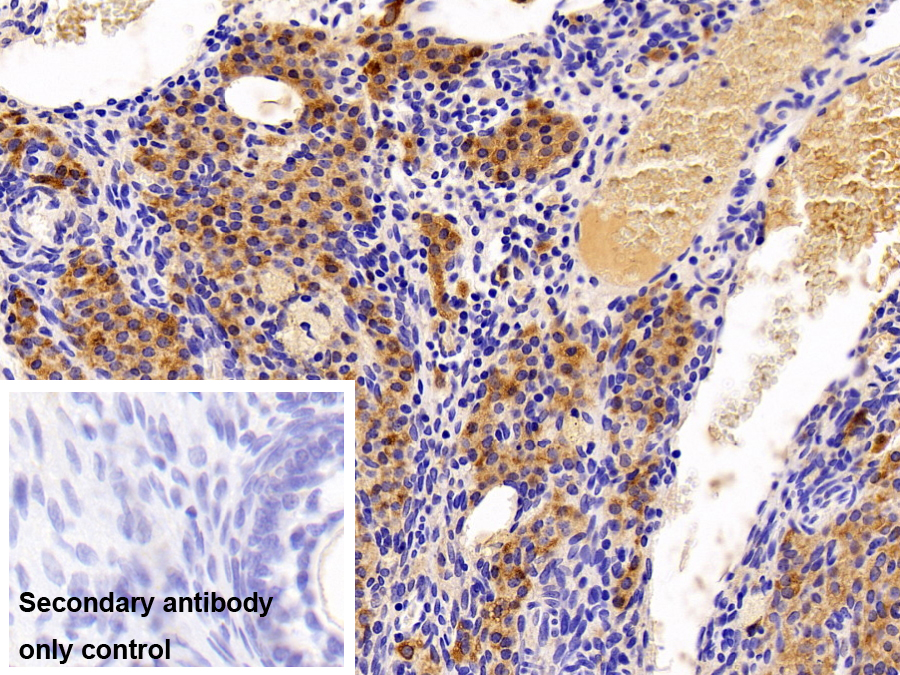 Polyclonal Antibody to Heart-type Fatty Acid Binding Protein (H-FABP)