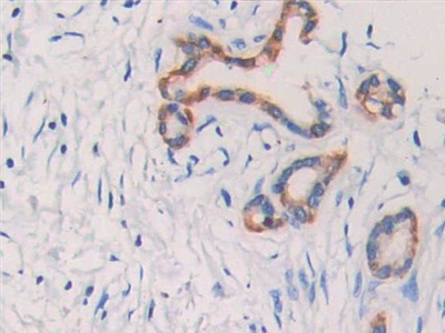 Polyclonal Antibody to Cytokeratin Fragment Antigen 21-1 (CYFRA21-1)