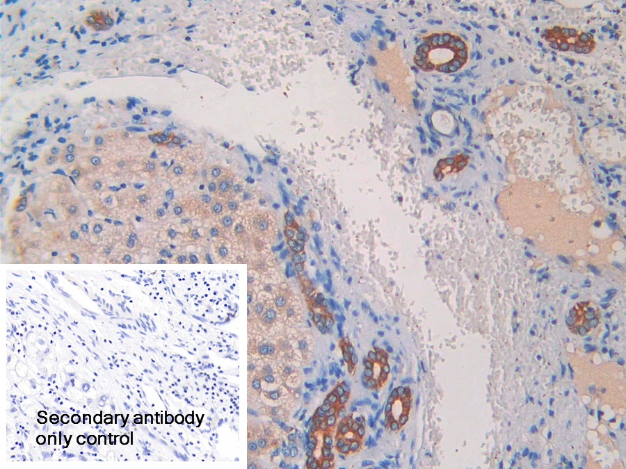 Polyclonal Antibody to Cytokeratin Fragment Antigen 21-1 (CYFRA21-1)