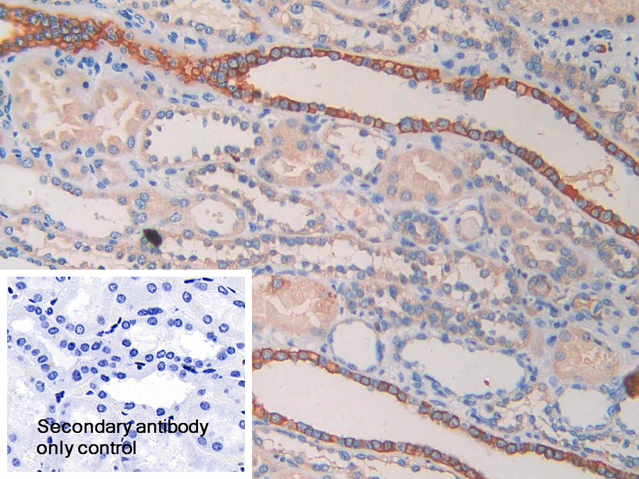 Polyclonal Antibody to Cytokeratin Fragment Antigen 21-1 (CYFRA21-1)