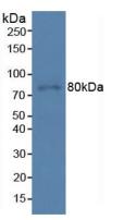 Polyclonal Antibody to Programmed Cell Death Protein 6 Interacting Protein (PDCD6IP)