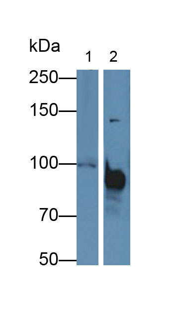 Polyclonal Antibody to Programmed Cell Death Protein 6 Interacting Protein (PDCD6IP)