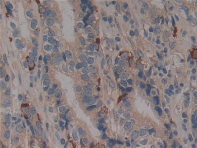 Polyclonal Antibody to Tumor Necrosis Factor Receptor Superfamily, Member 5 (CD40)