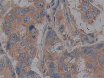 Polyclonal Antibody to Tumor Necrosis Factor Receptor Superfamily, Member 5 (CD40)