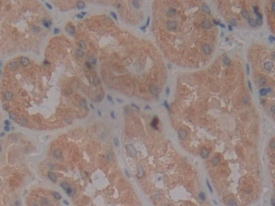 Polyclonal Antibody to Tumor Necrosis Factor Receptor Superfamily, Member 5 (CD40)