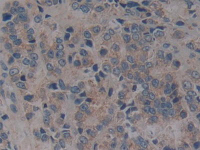 Polyclonal Antibody to Tumor Necrosis Factor Receptor Superfamily, Member 5 (CD40)